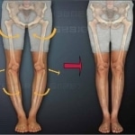 女性の脚がさまざまな位置で示されています。