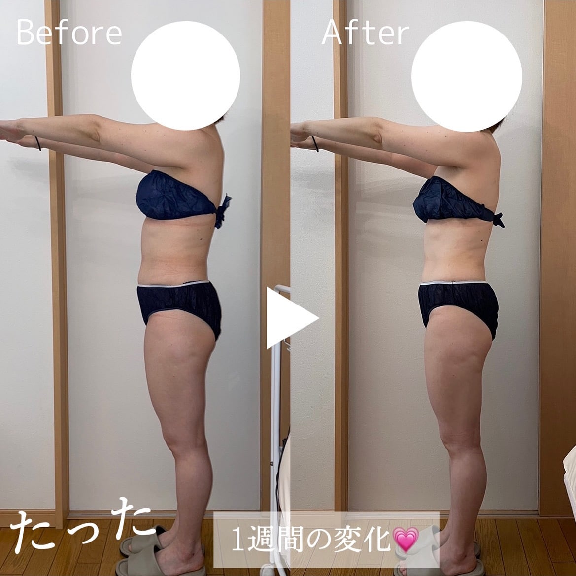 Streazzファスティングでお腹お腹ぺったんこ！ | 福山市の健康と美を